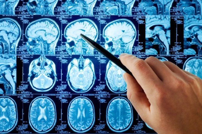 AdobeStock_20526724-1-750x500